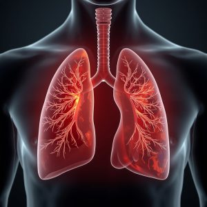 Penyakit Paru Obstruktif Kronis: Ancaman Serius bagi Perokok Aktif